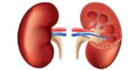 Insuficiencia renal