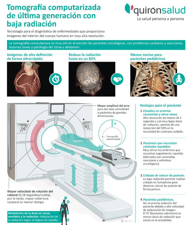 Infografia-tac-QS-madrid