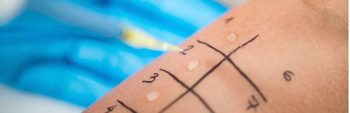 Alergologia Hospital Universitario Quironsalud Madrid