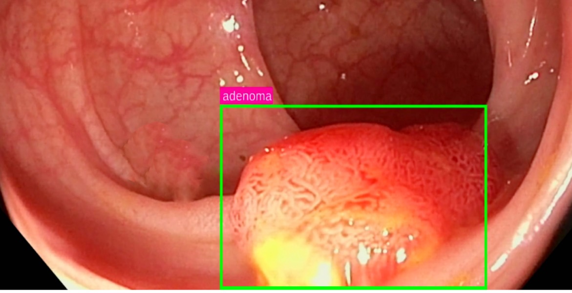Aparato Digestivo Hospital Universitario Quirónsalud Madrid