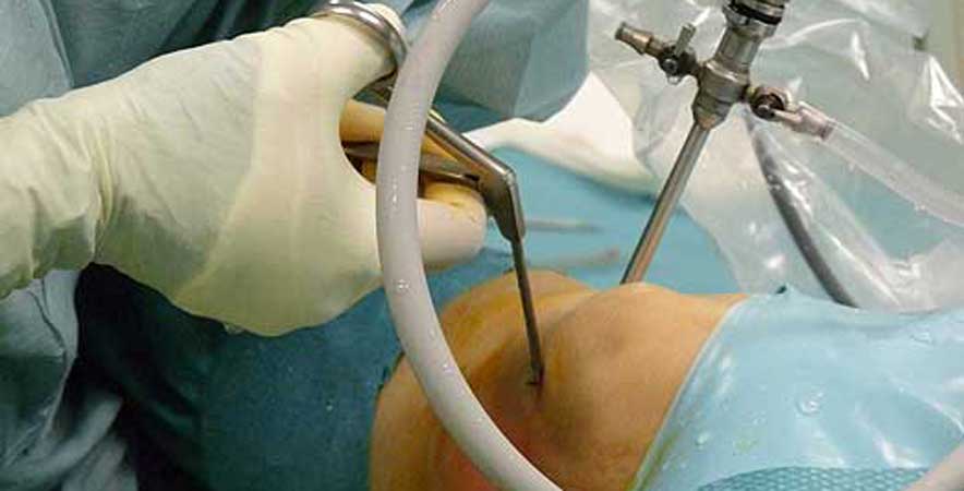 web_traumatologia_artroscopia_rodilla