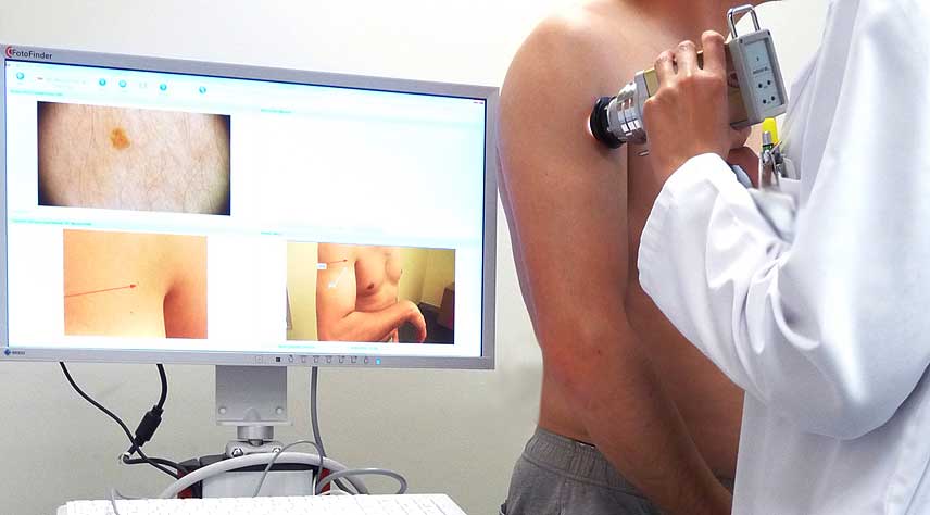 dermatoscopia_digital
