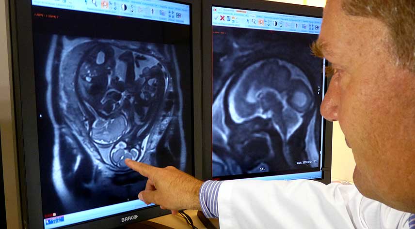 resonancia_magnetica_fetal