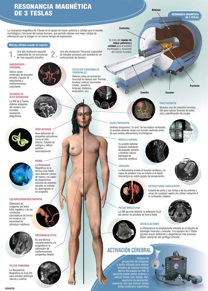 infografia_resonancia_magnetica_tres_teslas