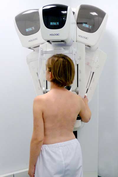 tomosintesis_cabezal