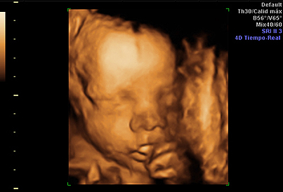 Eco4D_tercer_trimestre