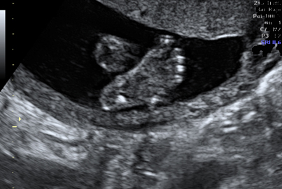 eco_segundo_trimestre_pie