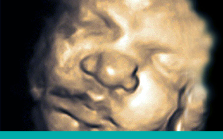 feto_tercer_trimestre