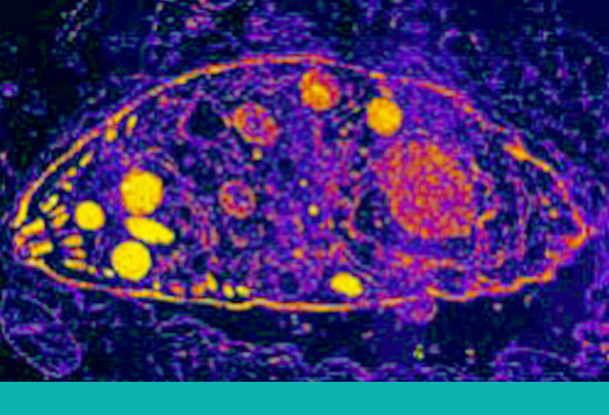 ginecologia_toxoplasma