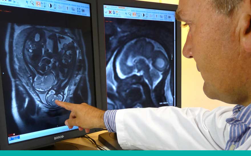 neonatologia_resonancia_fetal