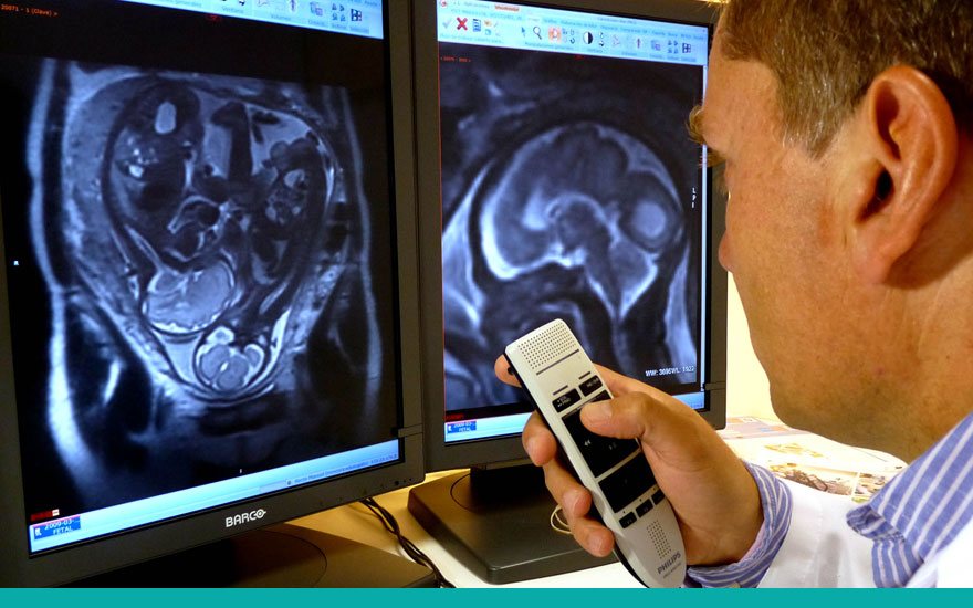 resonancia_magnetica_fetal