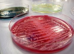 insuficiencia_renal_madrid