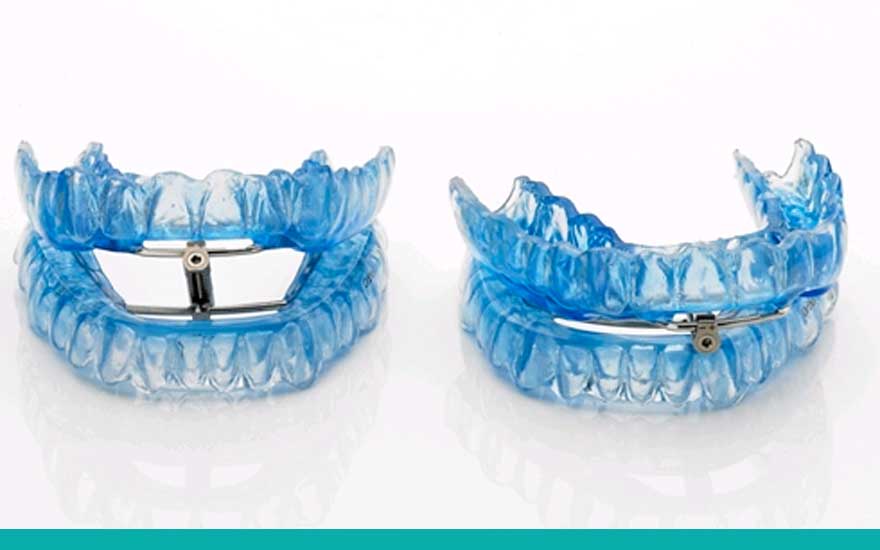 dispositivo-avance-mandibular