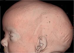 neurocirugia_pediatrica