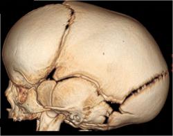neurocirugia_pediatrica