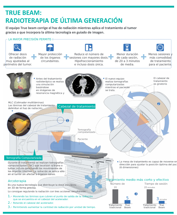 True Beam radioterapia de ultima generacion
