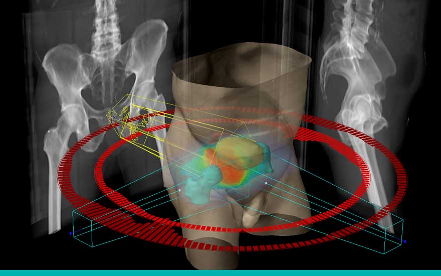 oncologia_radioterapica