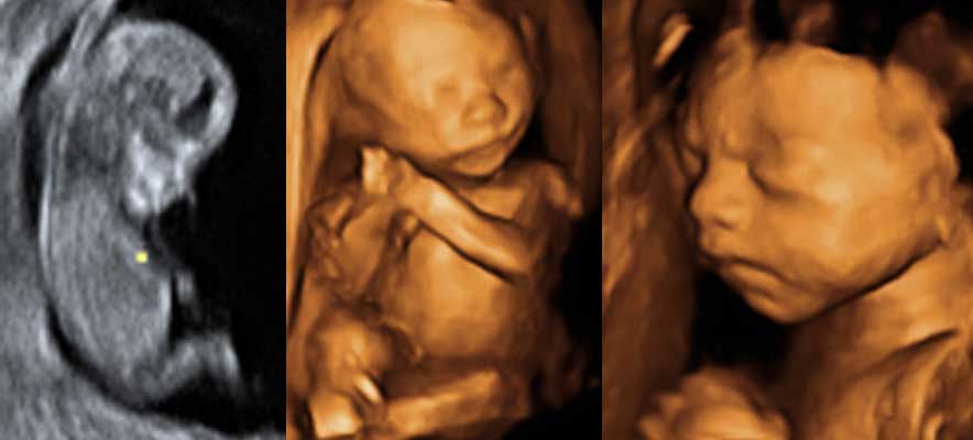 diagnostico perinatal