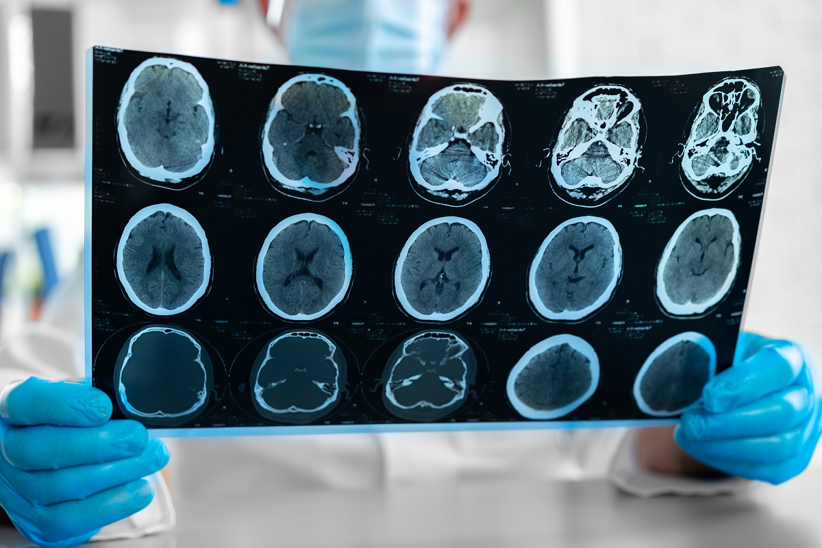 diagnostico por imagen que es murcia quironsalud