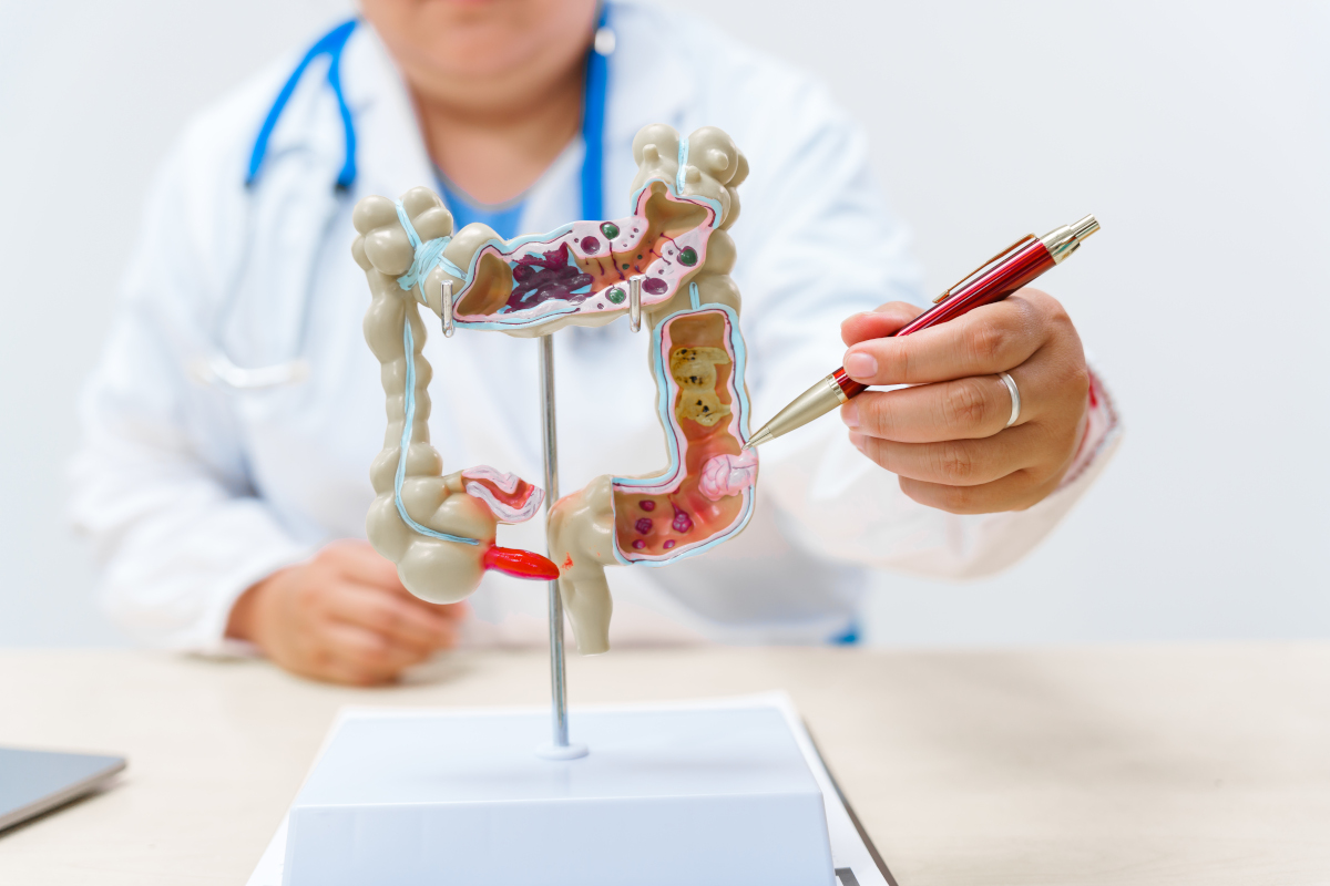 a-doctor-holds-a-human-colon-anatomy-model-demons-2025-03-09-22-06-55-utc_2