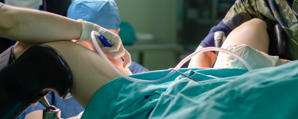 Se puede ser madre tras una histerectomía Quirónsalud Murcia ginecología