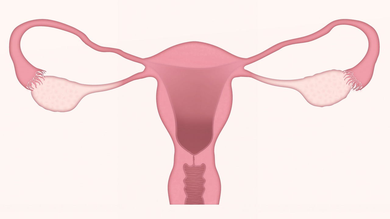 Miomectomía miomatosis uterina miomas quironsalud Murcia
