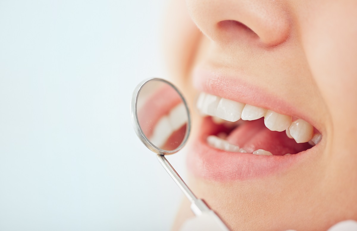 periodoncista murcia