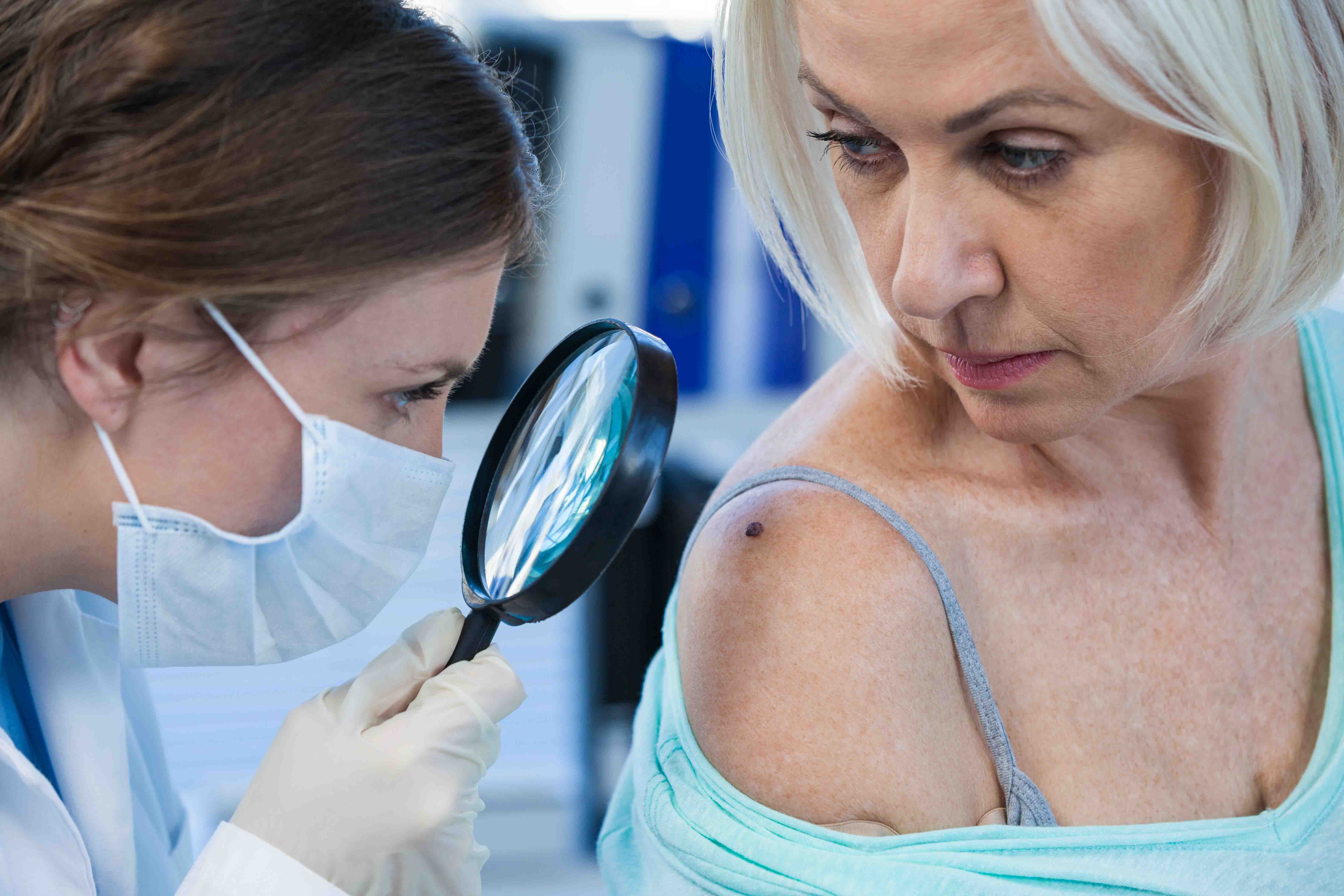 Cirugía de Mohs quirónsalud Murcia