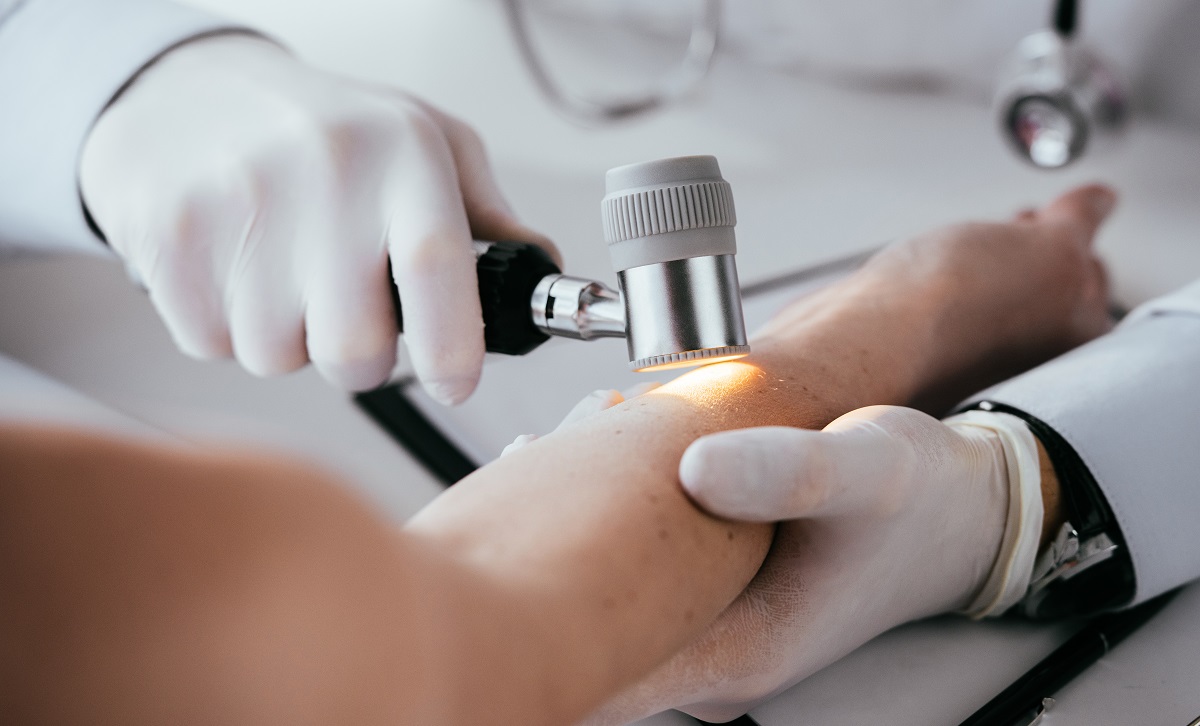 cropped-view-of-dermatologist-examining-hand-of-wo-K7BCTR3