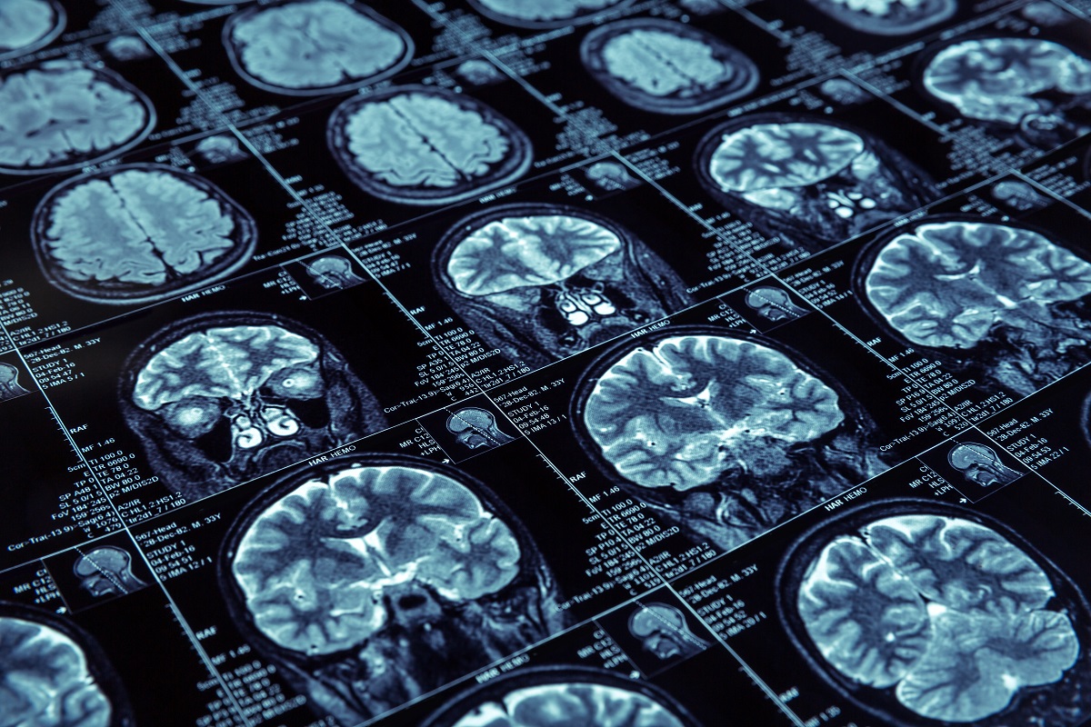 diagnostico por imagen tenerife