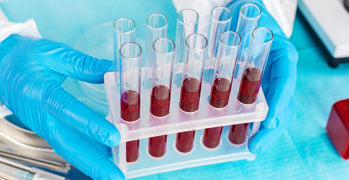 analisis clinicos quironsalud