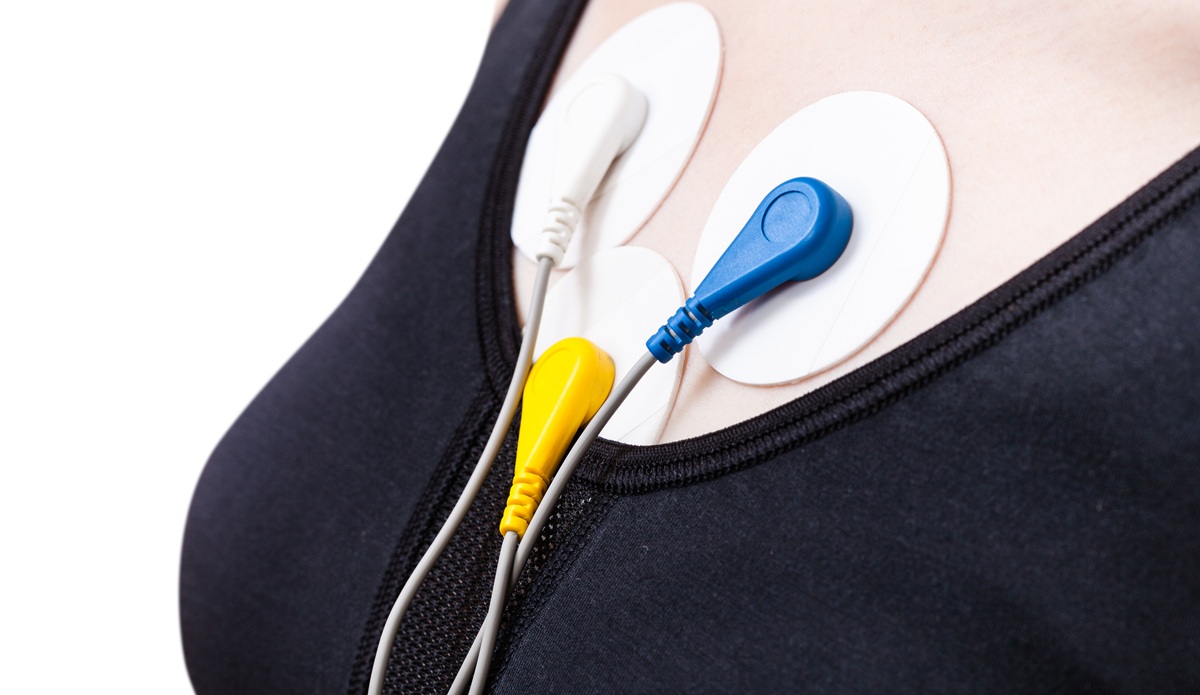 Pruebas Diagnósticas Cardiológicas en Tenerife