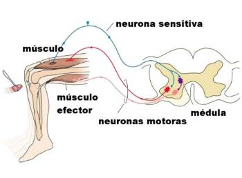 Dolor y Alzheimer