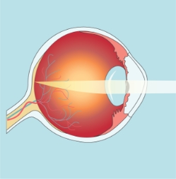 Retina-Degeneracion-QueEs-01