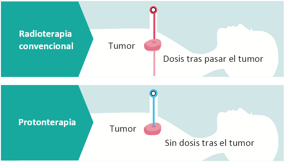 ¿Qué tienen de especial los protones?.