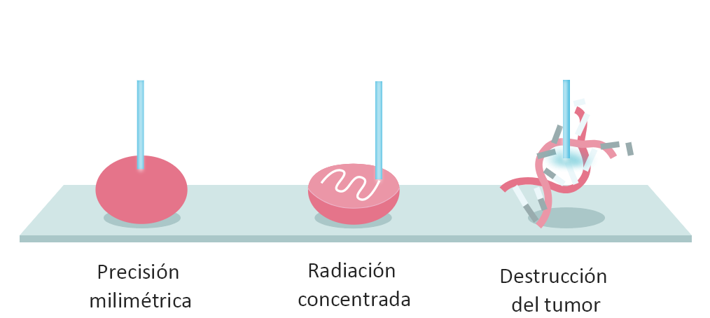 Cómo actúan los tumores sobre el tumor