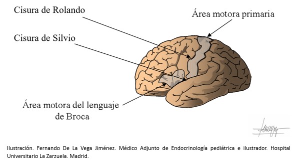 Epilepsia rolándica_2