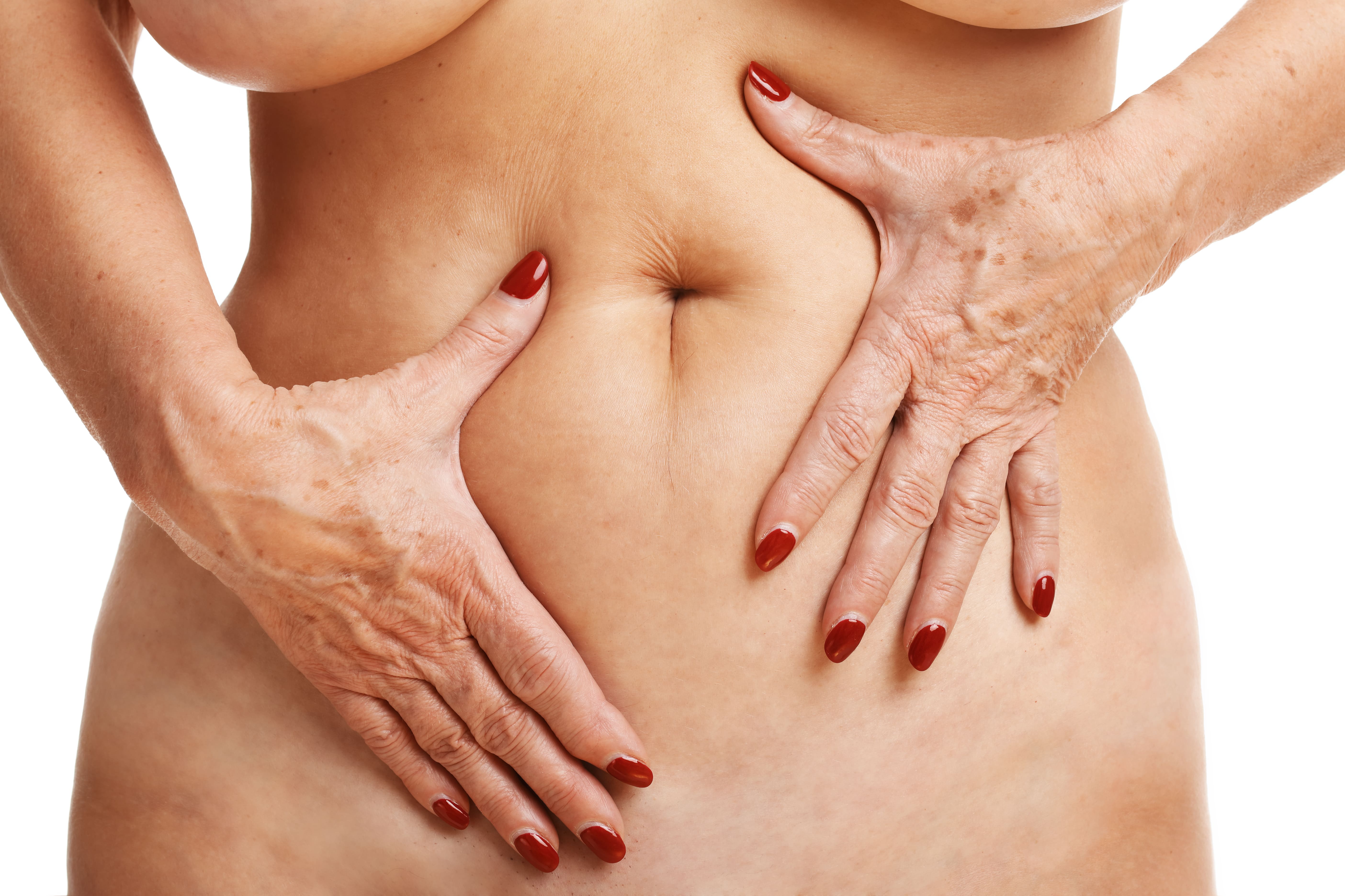 diástais abdominal mujer después del parto