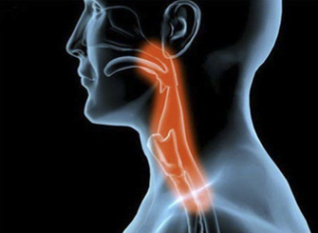 Qué es la disfagia? ¿Como se maneja? | Blogs Quirónsalud