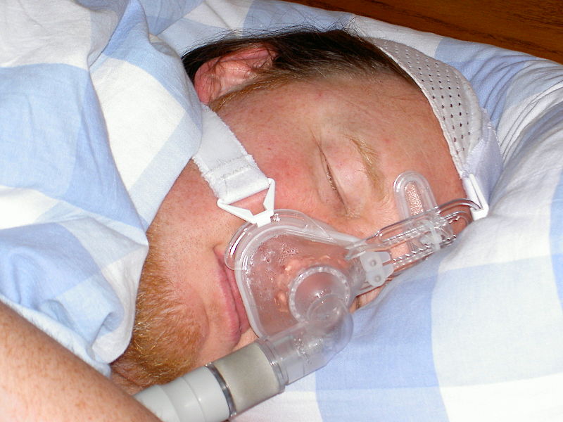 Cómo combatir la apnea obstructiva del sueño