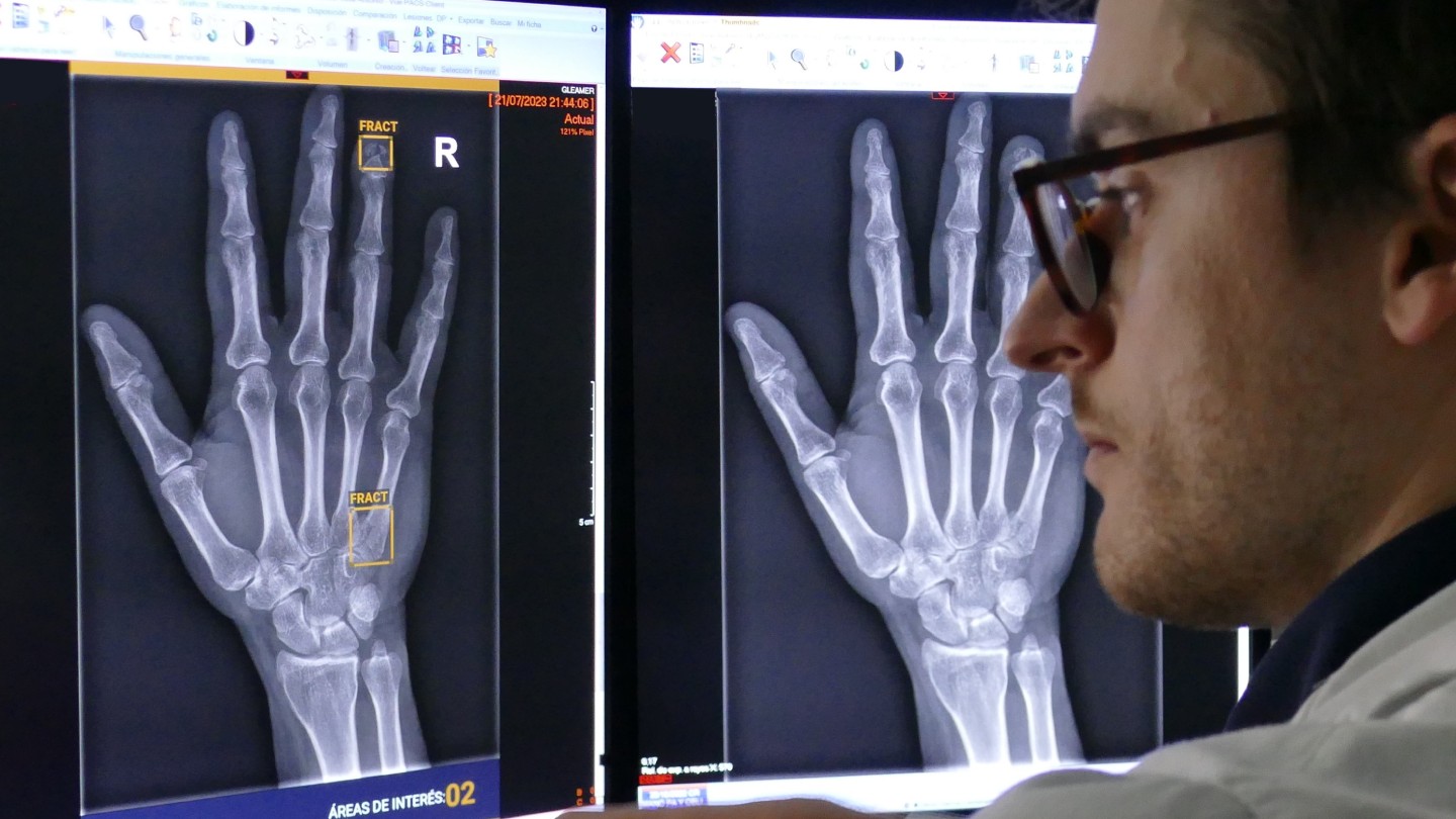 La inteligencia artificial ayuda al análisis de imágenes radiológicas en el  Hospital Universitario Quirónsalud Madrid | Quirónsalud, image size:1440x810