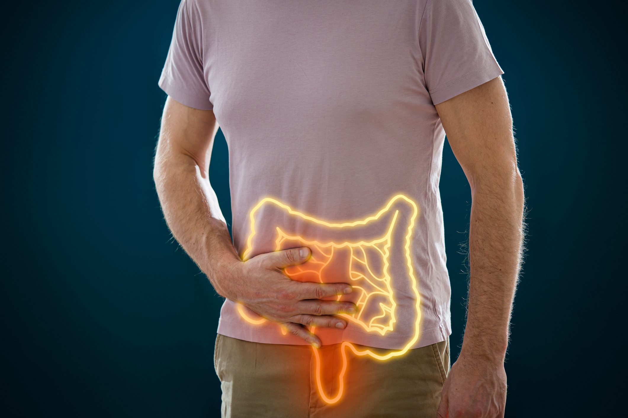 foto recurso cancer de colon