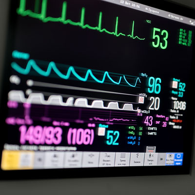 Arritmias y Electrofisiología