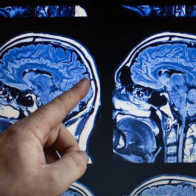 Neurodiagnóstico