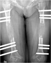 Imagen13-1-245x300
