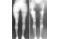 femoral-10
