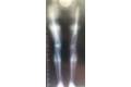 femoral-09-