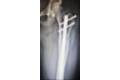 femoral-07-