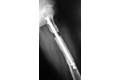 femoral-06-