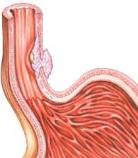 Figura-2-2